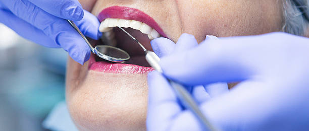 Best Emergency Root Canal Treatment in Lofall, WA