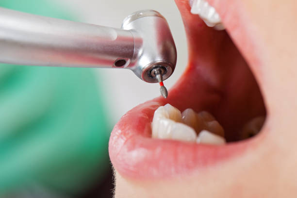 Best Emergency Orthodontic Repairs in Lofall, WA